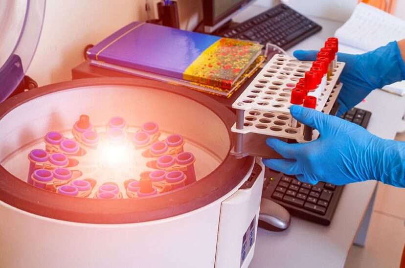 Beneficios de la luz pulsada en la industria de alimentos